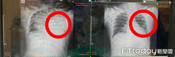 ▲豐原醫院,張正一。（圖／豐原醫院提供）