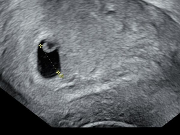 ▲▼鄭家純懷孕9週流產「深夜痛到叫出聲」。（圖／翻攝自Facebook／鄭家純）