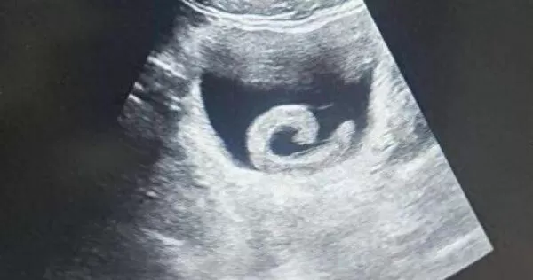 大陸河南省鄭州市近日發生一起離譜卻值得警惕的醫療事件。（圖／翻攝自微博）