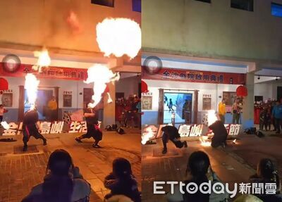 直播全拍下！金門火舞噴火失控「回燃燒臉」　舞者緊急送回台灣