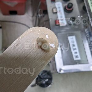 50%人都有！一張嘴「米白顆粒」臭到爆　醫揭台人1壞習慣養結石