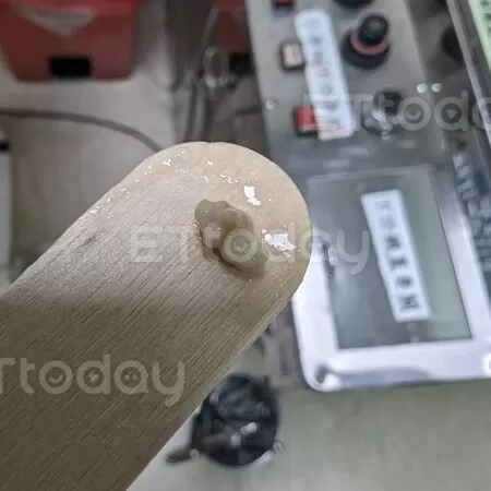 ▲扁桃腺結石。（圖／李晏廷授權提供，未經同意請勿任意翻攝）