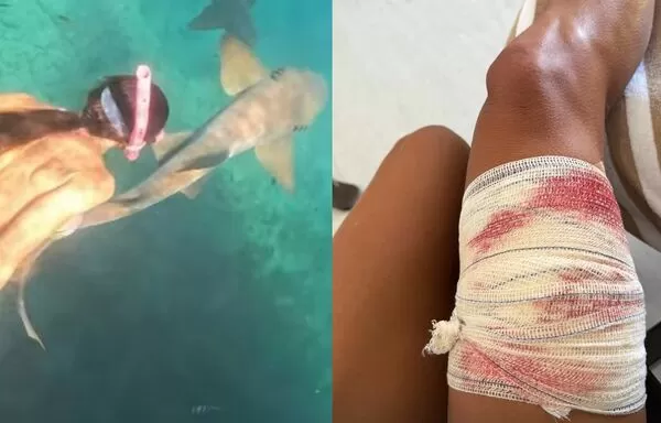 浮潛遭鉸口鯊「狠咬大腿不放」　女拍下驚悚瞬間：想把我往下拖。（圖／翻攝自Instagram／taydalazen）