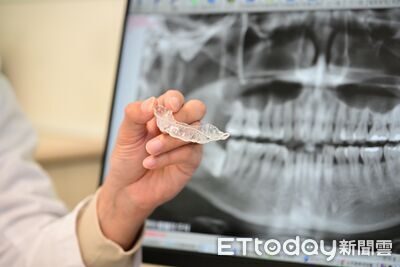 台中闆娘牙縫變大嚇壞　醫揭「這恐怖習慣」惹禍：牙齦全萎縮