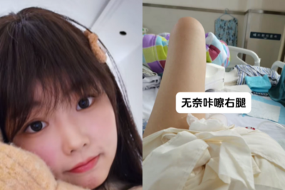 陸正妹網紅確診「骨癌截肢」遭父母拒往來　她苦笑：媽說我是累贅