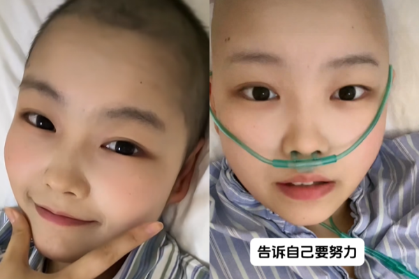 ▲夏夏化療時樂觀自拍。（圖／翻攝自抖音）