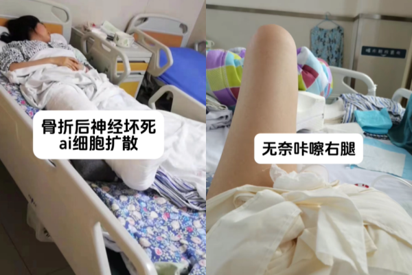 ▲夏夏表示，母親陪自己就醫一年後，便承受不住壓力跟她斷絕關係了。（圖／翻攝自抖音）