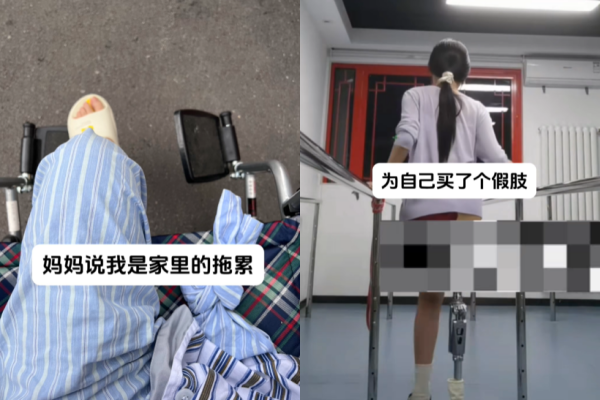 ▲夏夏自己存錢買義肢。（圖／翻攝自抖音）