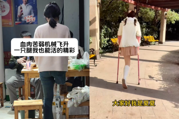 ▲▼陸正妹確診「骨癌截肢」遭父母斷絕關係。（圖／翻攝自抖音）
