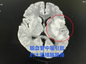 27歲青農腦中風！8小時橫跨128公里接力搶救　15天後重回田裡