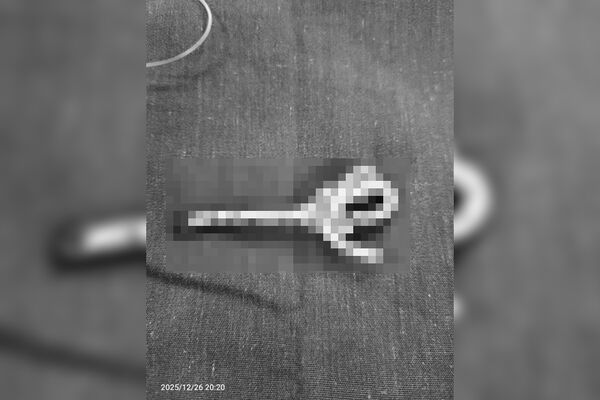 35cm網路線「插進尿道」！越15歲少年下體劇痛送醫…只能切開保命