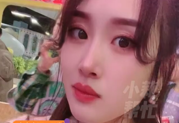 ▲▼38歲女吐一夜突發腦梗。（圖／翻攝自微博）