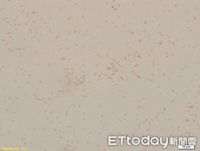 「產氣克雷伯氏菌」爆院內群聚　醫揭傳播3關鍵：社區內也有