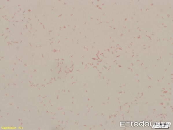 ▲▼      產氣克雷伯氏菌       。（圖／醫師提供）