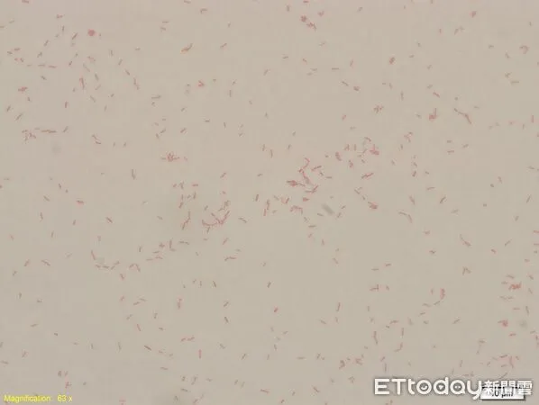 ▲▼      產氣克雷伯氏菌       。（圖／醫師提供）