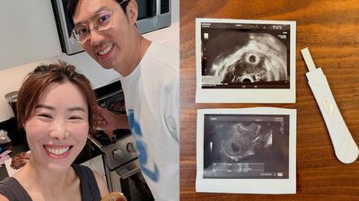 45歲懷第三胎！金老佛爺曝「高齡懷孕」心碎轉折：寶寶離開我了