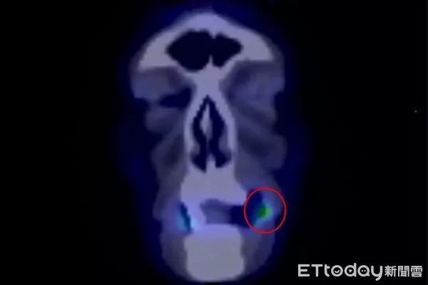 ▲林佳逢,口腔,耳鼻喉科。（圖／光田醫院提供）