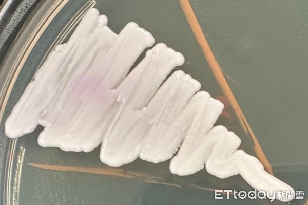 ▲▼      耳念珠菌       。（圖／醫師提供）