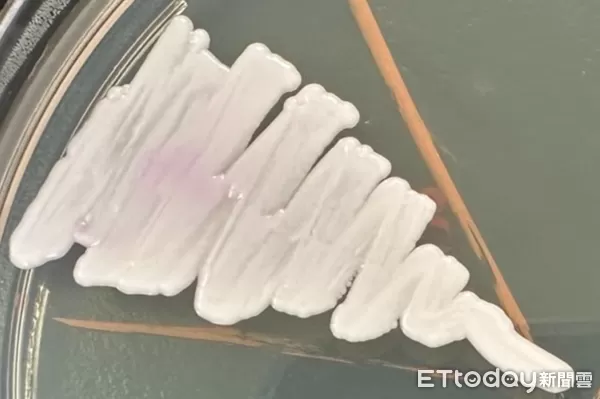 ▲▼      耳念珠菌       。（圖／醫師提供）