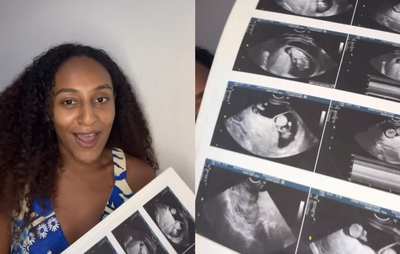 懷孕期間再懷孕　年輕媽同時「自然產+剖腹產」生下差一周雙胞胎