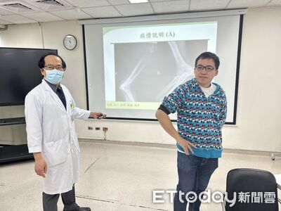 油漆師傅摔下梯子右手骨折變形！醫師「軟硬兼施」讓他重返職場