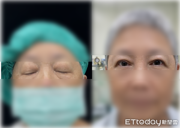 ▲呂明川。（圖／中港澄清醫院提供）