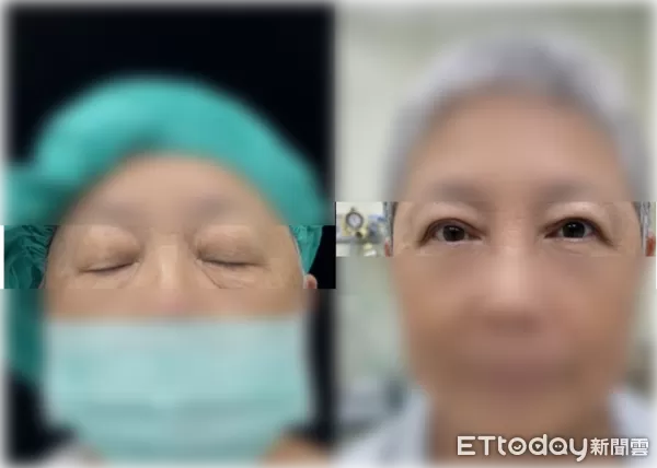 ▲呂明川。（圖／中港澄清醫院提供）