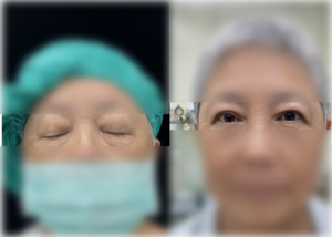 不是鬼遮眼！台中女「眼皮跳到睜不開」　醫示警：5大症狀快就醫