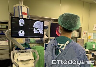 女「乾冷就臉痛」竟是慢性鼻竇炎　醫靠內視鏡手術改善