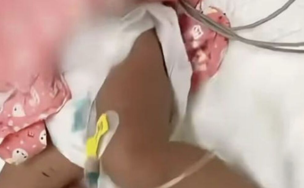 ▲大陸一名男嬰被母親用針扎放血，令人看了十分不捨。（圖／翻攝大風新聞）