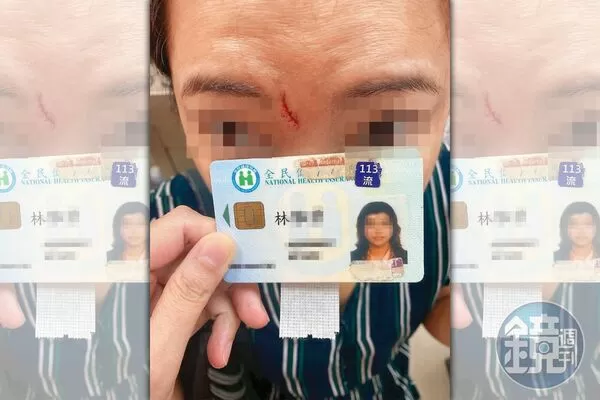 →女律師在浴室2度昏倒、眉心撞上水龍頭，受傷破相。（讀者提供）