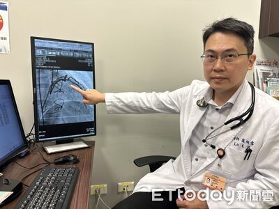 台中女心臟血管硬如水管　醫用震波打通救命