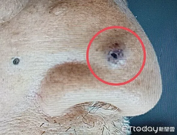 ▲何英右,皮膚科。（圖／台中光田醫院提供）