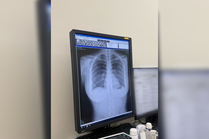 ▲▼豐島心櫻的X光照在網路上引起極大討論。（圖／翻攝X、IG／豊島 心桜）