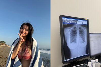 寫真偶像炫耀X光照「肺很乾淨」！畫面狂吸3千萬瀏覽　網友大歪樓
