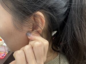 手腳冰冷常見4體質　中醫教「揉耳朵」2分鐘暖全身