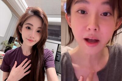 馮提莫罹甲狀腺癌「手術割脖保命」　直播曬疤痕：老天的禮物