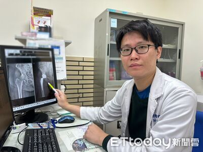嘉榮「正前開」人工髖關節術　75歲患者術後當天下床走路