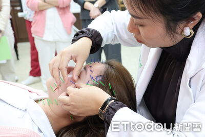 自然系醫美成趨勢　天主教若瑟醫院推針灸美容新選擇