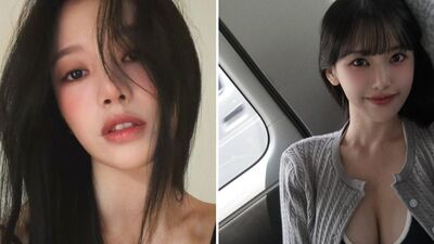 蔡瑞雪突PO「脖子紅腫照」！厚敷藥膏慘況曝  認了確診這病症：治療中