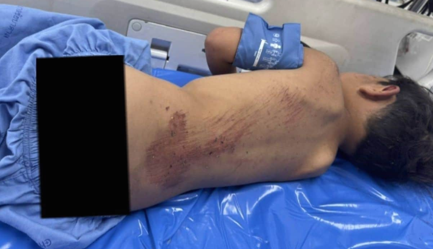 ▲▼泰男童遭「阿嬤31歲小男友」凌虐丟包深山。（圖／翻攝自Khaosod）