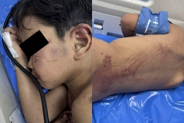 以為打死了!泰男童遭阿嬤31歲小男友「棄屍深山」 奇蹟撿回一命