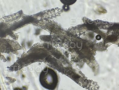 爛痘搞1年!女大生臉「百隻8腳蟲蠕動」猛生小孩 醫:妳餵飽牠們