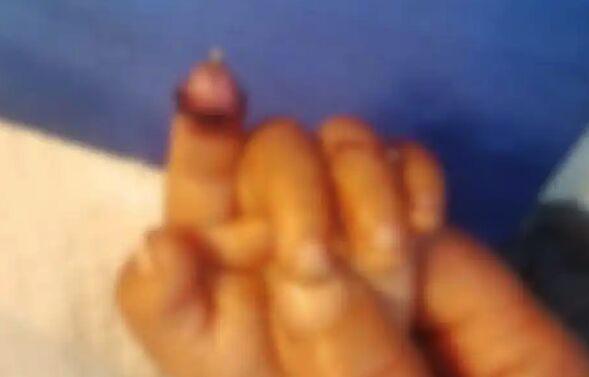 ▲▼陸男童餵兔子「食指被咬斷」　開膛破肚找斷指「結果牠沒吞」。（圖／翻攝微博）