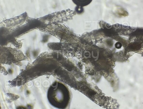 ▲▼爛痘搞1年！女大生臉上「萬隻8腳蟲」狂生小孩　醫：妳餵飽牠們了。（圖／王佑鑫醫師授權提供，未經授權請勿任意翻攝）