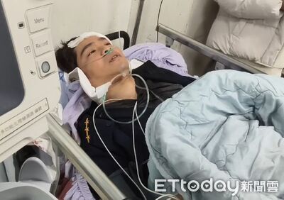 苗栗33歲警頭被砍出2大洞！長達10cm滿臉血...顱骨骨裂ICU觀察中