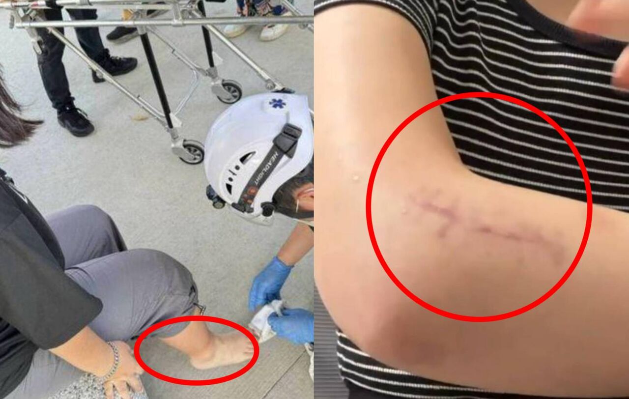 網美遊戲場1天2傷!女溜滑梯手骨折...國中生斷腳 控縣府拒賠償