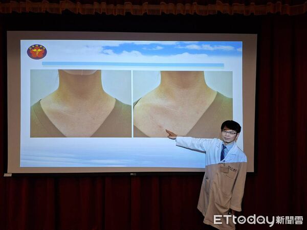 ▲▼       三總新手術      。（圖／記者邱俊吉攝）