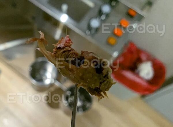 ▲別再用棉花棒挖！「洋蔥巨屎」塞爆他耳道　醫夾出驚喊：地表最猛。(圖／李晏廷醫師獨家授權提供)