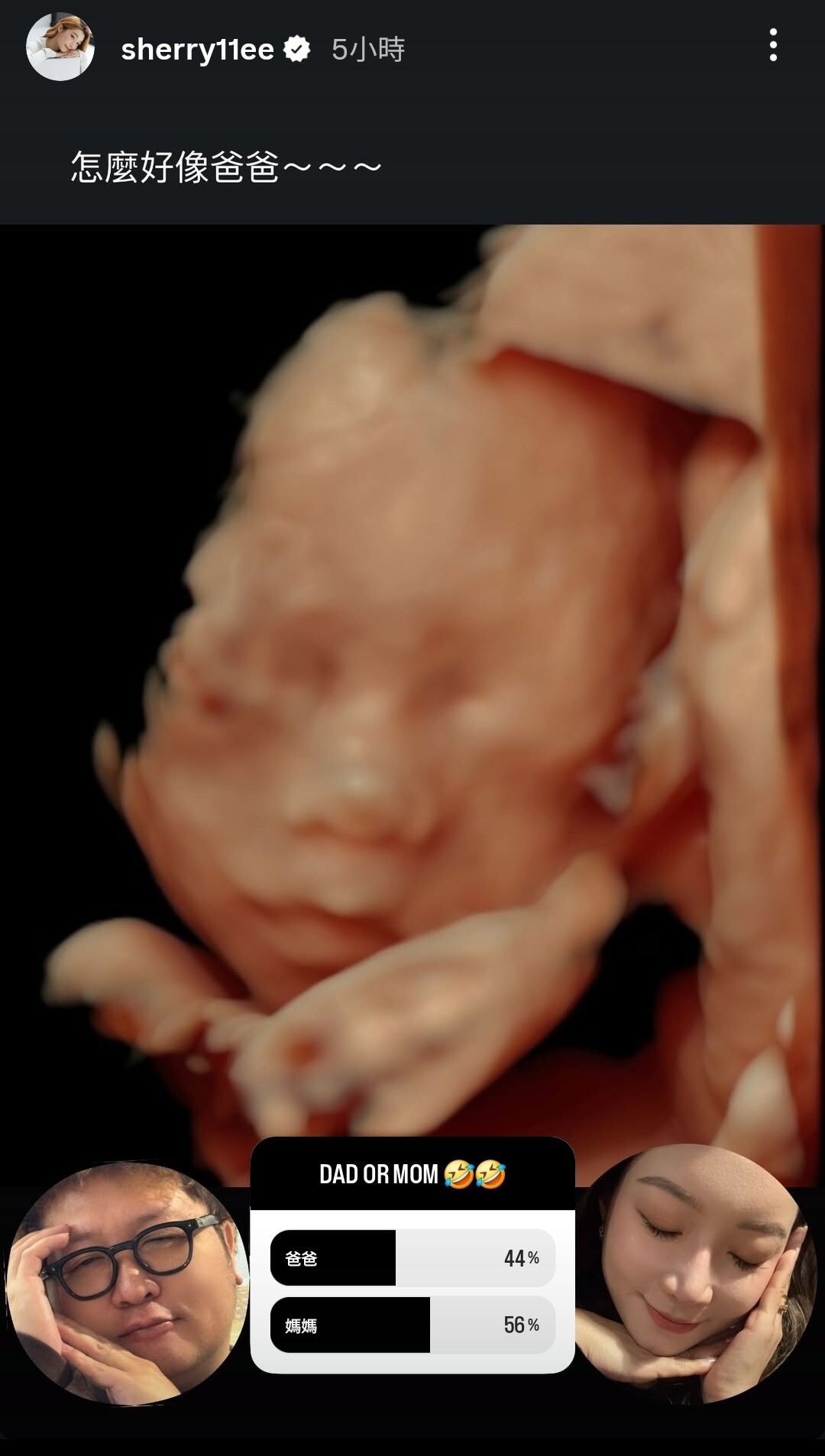 ▲▼依依曬4D超音波照「女兒長相首曝光」：怎麼好像爸爸。（圖／翻攝自Instagram／sherry11ee）